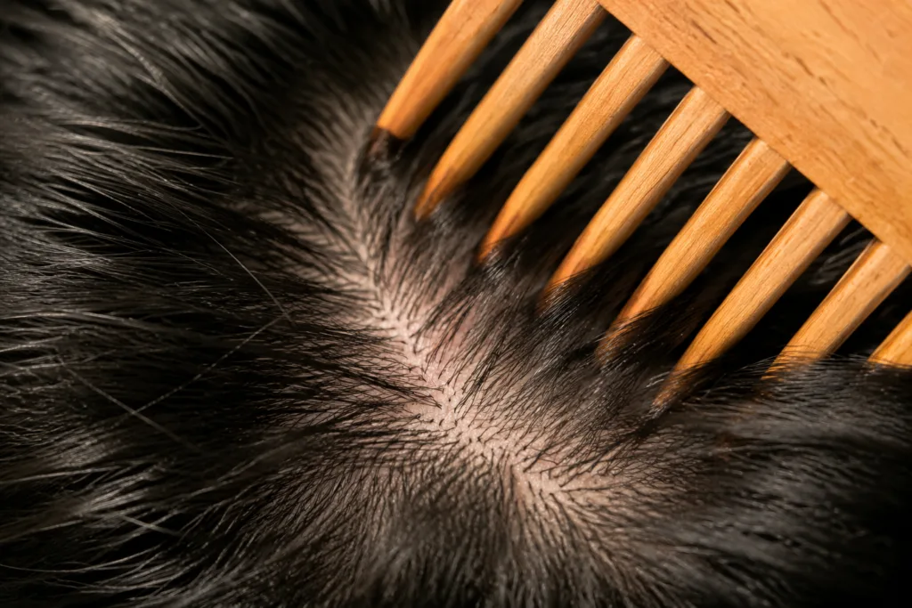 wooden comb scalp circulation